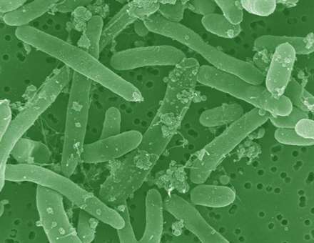 Bacteria OGM_100214